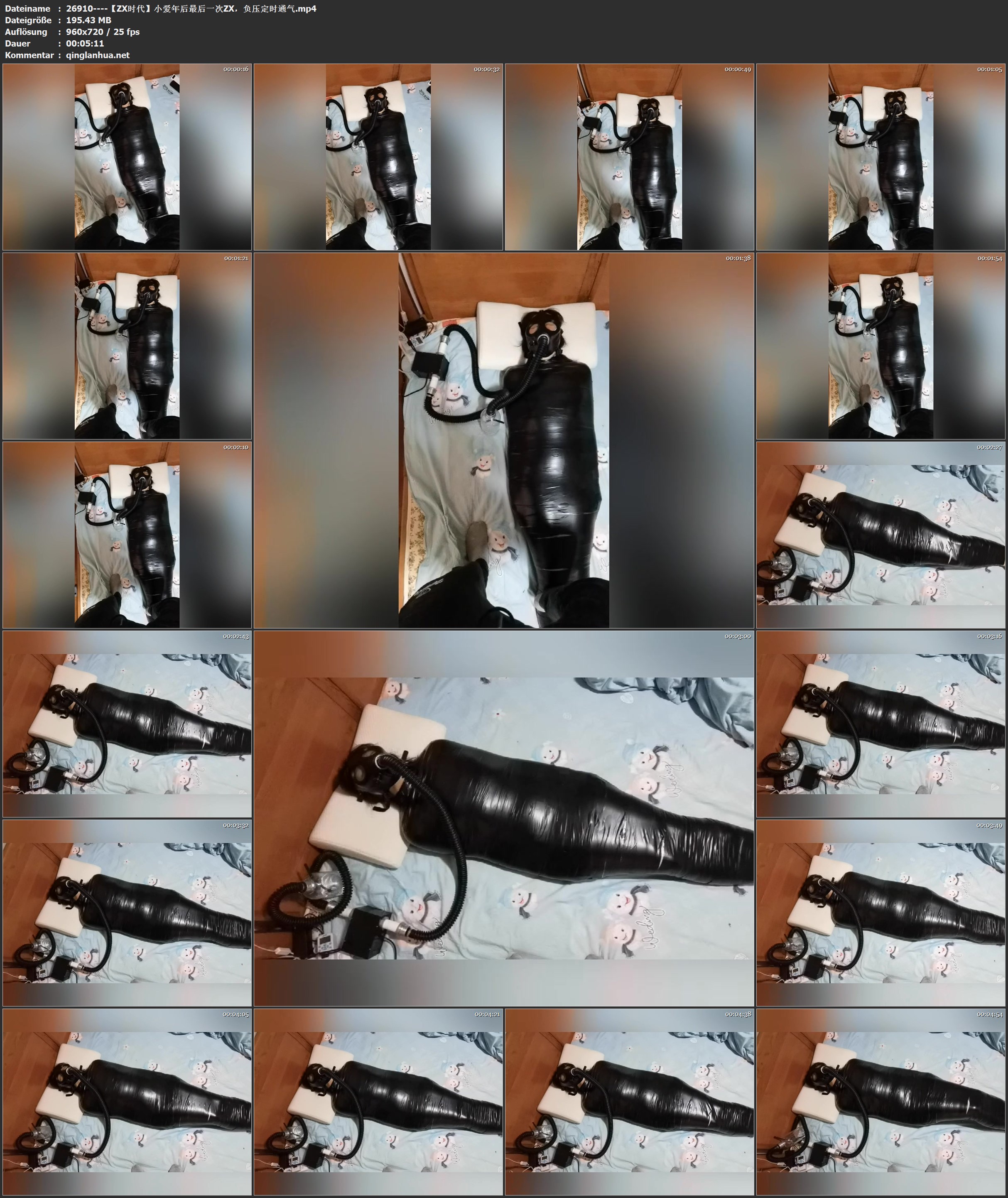 26910----【ZX时代】小爱年后最后一次ZX，负压定时通气.jpg
